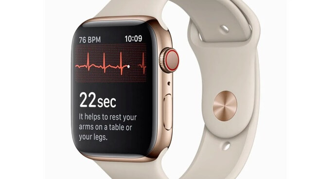 ЭКГ Apple Watch обнаруживает состояние сердца у немки