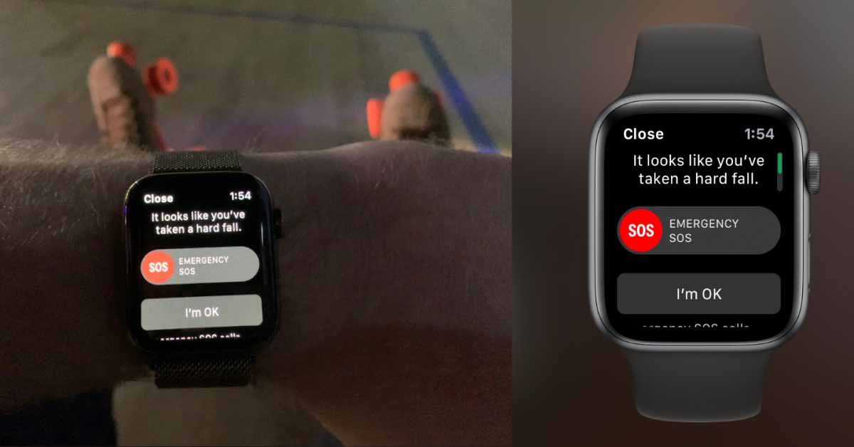 Apple Watch спасают жизнь мужчине после того, как он упал в обморок и ударился головой об пол