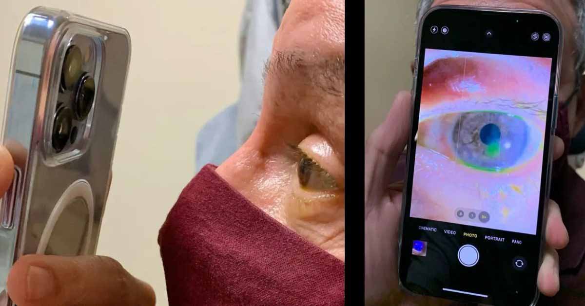 Офтальмолог с iPhone 13 отвечает на критику