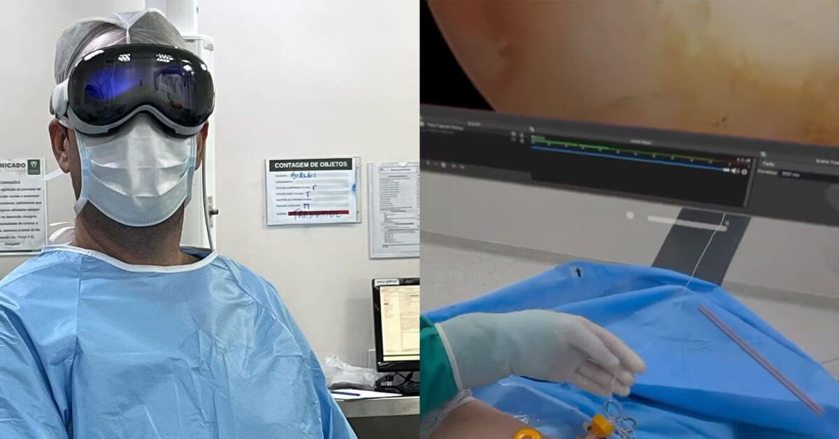 Apple Vision Pro использовался для помощи врачу во время операции на плече