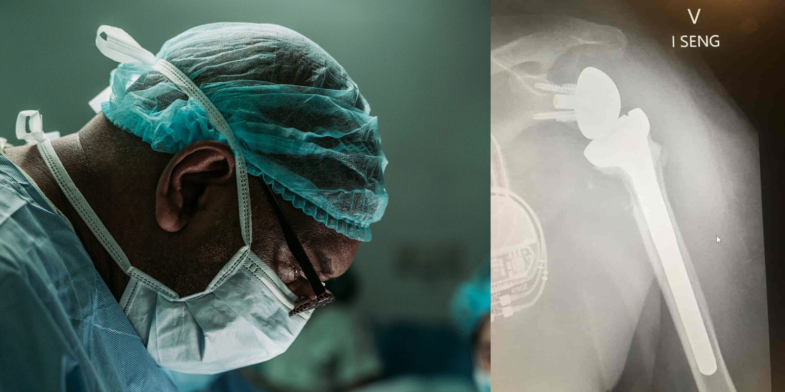 Vision Pro-ассистированная хирургия |  Хирург и рентген обратной замены плеча