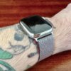 Проблемы с Apple Watch вынудили одного пользователя удалить татуировку